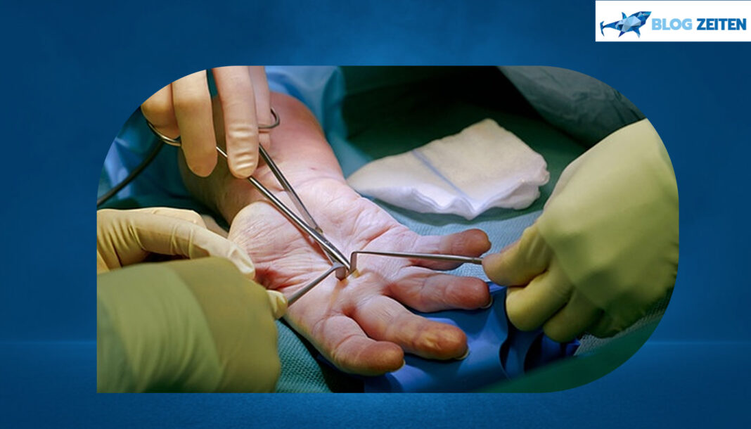 Handchirurgie